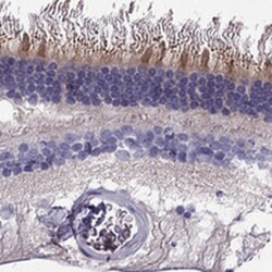 Kv8.2 Antibody, Novus Biologicals 25 &mu;L; Unlabeled:Antibodies, Polyclonal